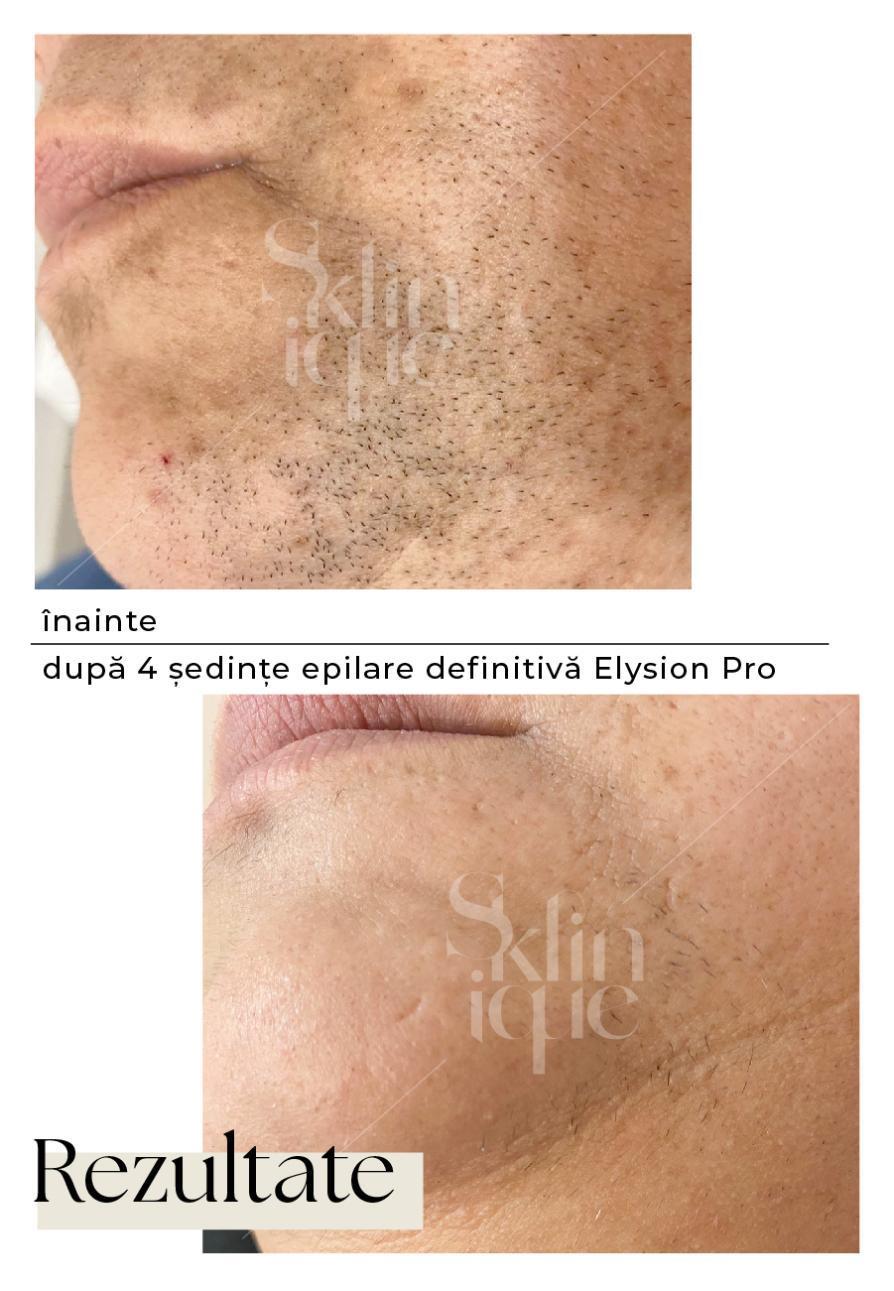 barbie inainte si dupa